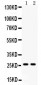 Anti-DUT Antibody